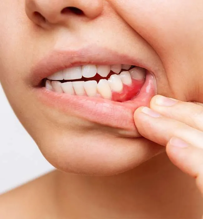 Invisalign clinic in Trivandrum