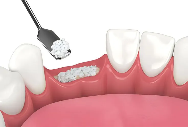 Orthodontic Treatment in Trivandrum