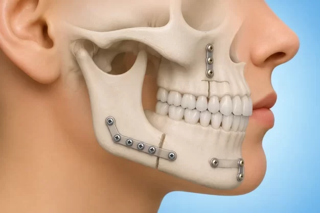 Orthodontic Treatment in Trivandrum