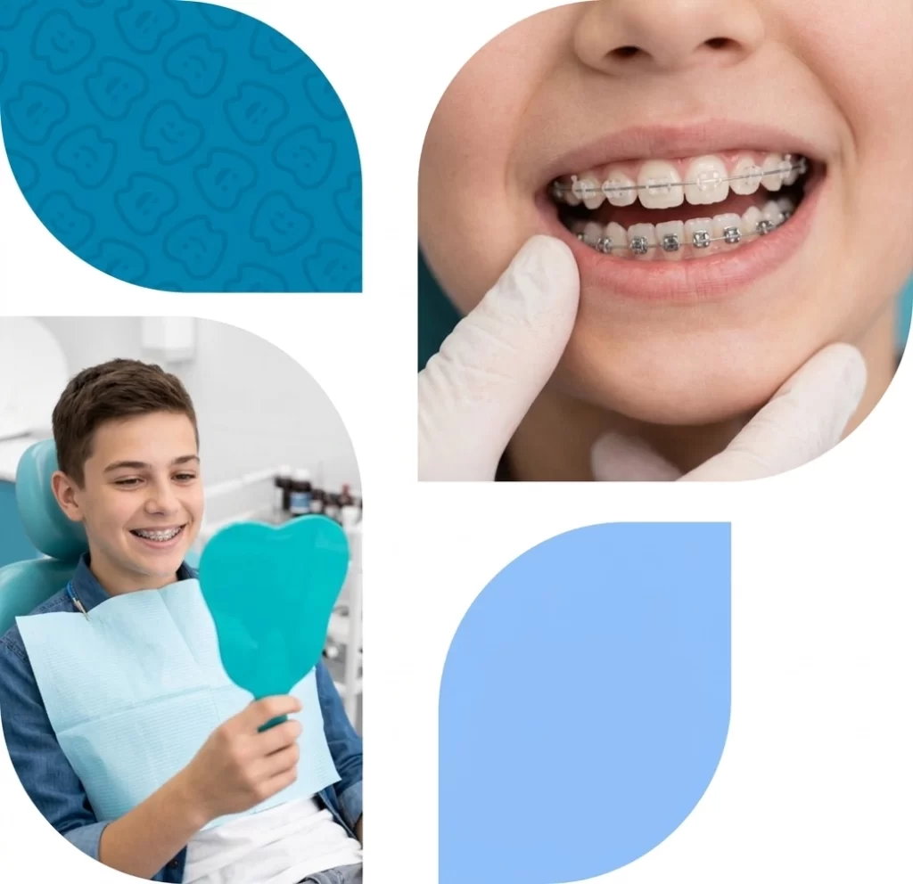 Orthodontic Treatment in Trivandrum