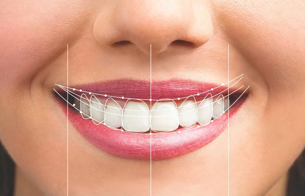 Smile Design services in Trivandrum