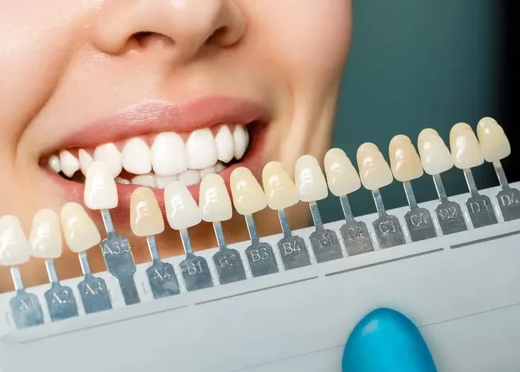 Invisalign clinic in Trivandrum