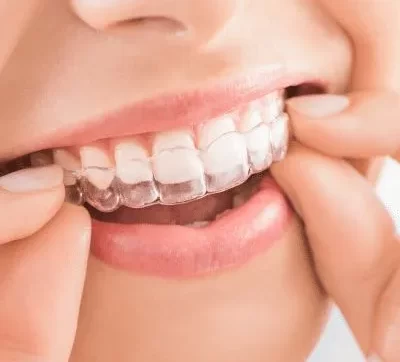 Best Dentist in Trivandrum