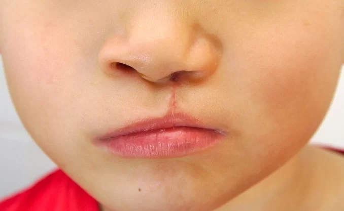 Best dentist in Trivandrum