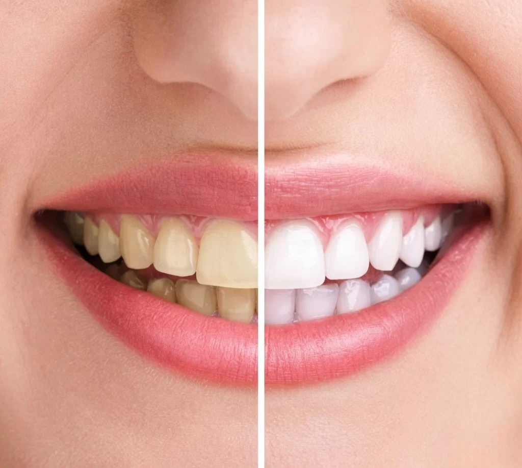 Smile design service in Trivandrum