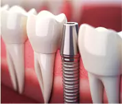 Dental Check ups in Trivandrum