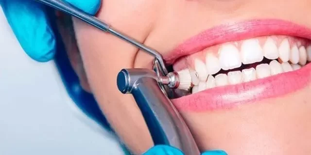 Root Canal Treatment in Trivandrum