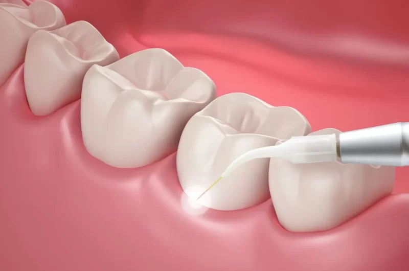 Dental Care in Trivandrum