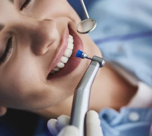 Teeth whitening services in Trivandrum